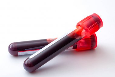 苯胺-4羟化酶活性检测试剂盒 苯胺-4羟化酶活性检测试剂盒