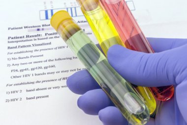 游离睾酮(F-TESTO)elisa检测试剂盒图1 游离睾酮(F-TESTO)elisa检测试剂盒图1