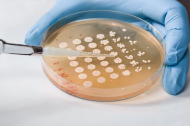 生物素亲和素ELISA试剂盒系统介绍 生物素亲和素ELISA试剂盒系统介绍