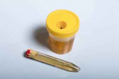 人对氧磷酶1(PON1)酶联免疫elisa试剂盒 人对氧磷酶1(PON1)酶联免疫elisa试剂盒