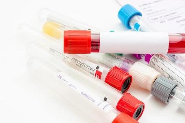 HPLC高效液相色谱可以检测哪些维生素？